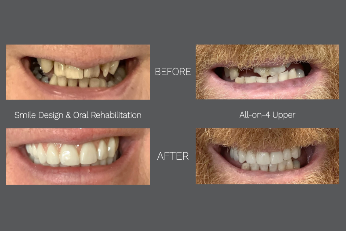 Before and after 